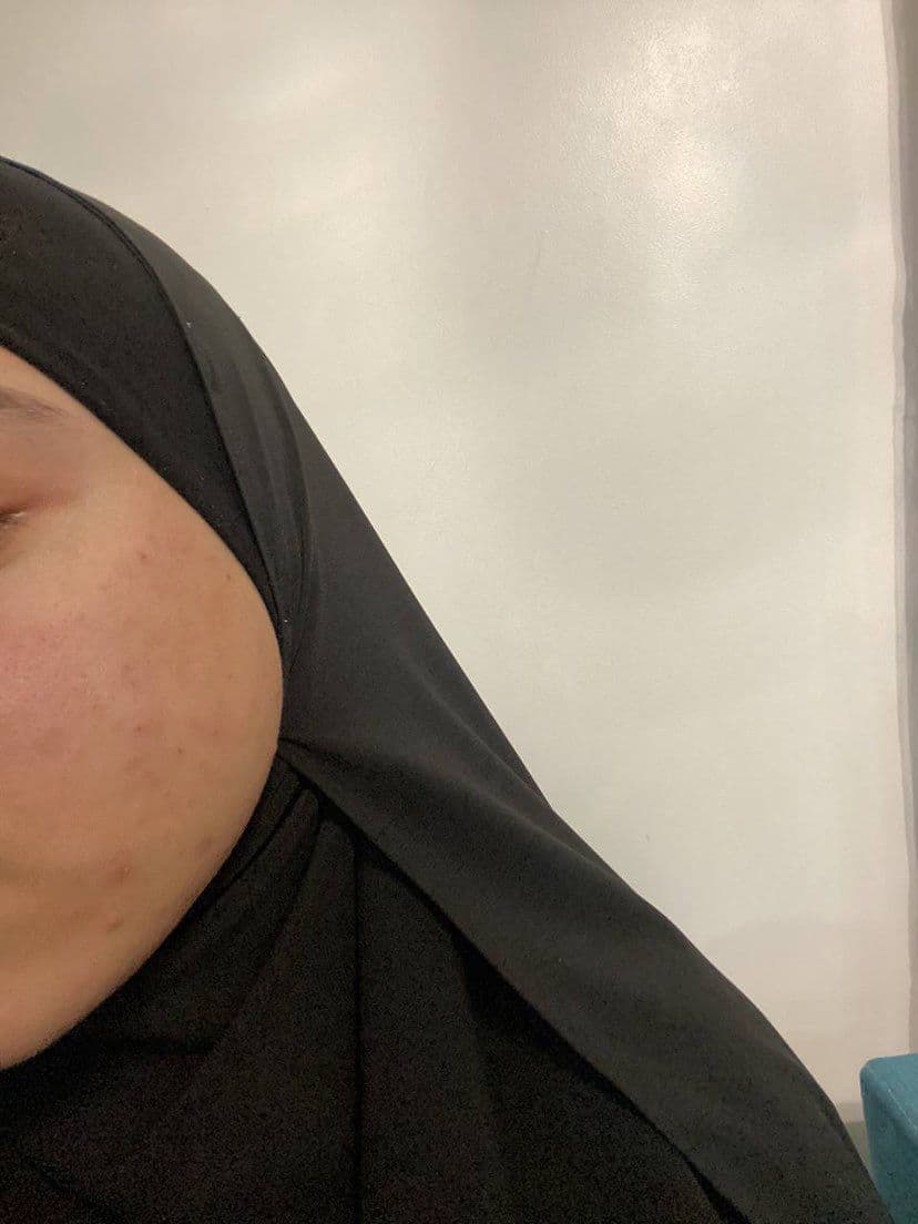 نتيجة رقم 1 — بعد