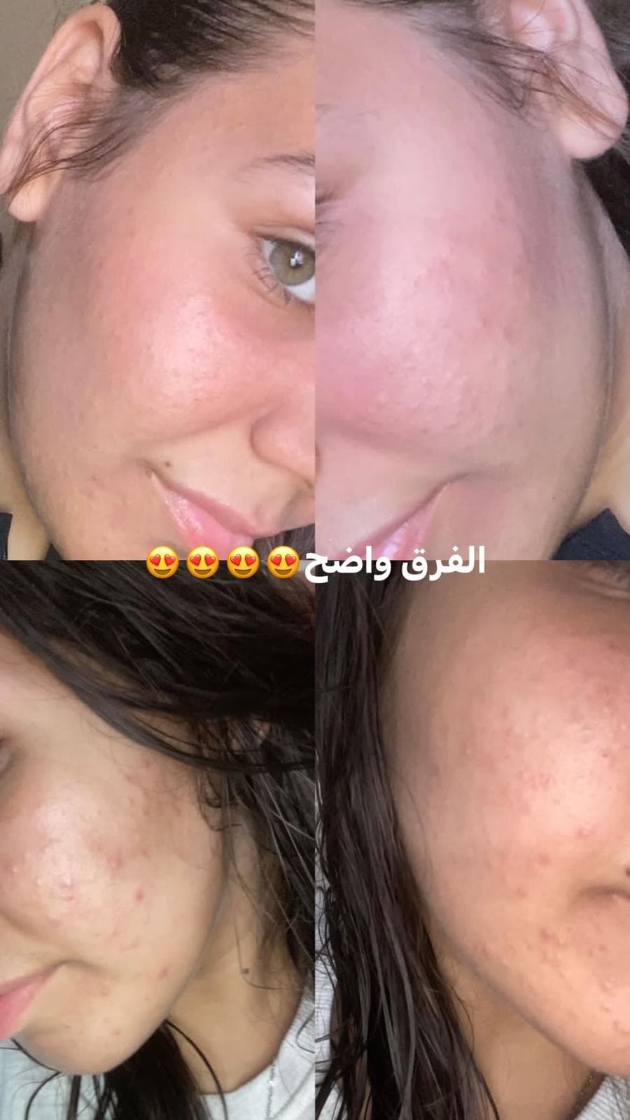 قبل وبعد — حالة 2