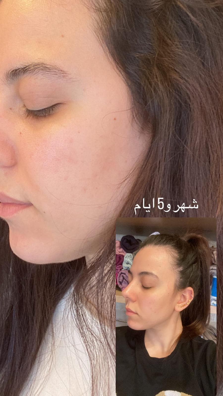 قبل وبعد — حالة 4
